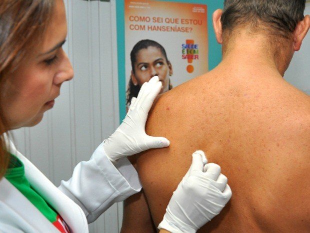 Brasilsegundopascommaiscasosdehansenasenomundo_0206363001708132112.jpeg