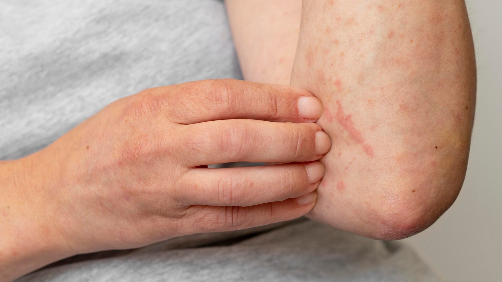 Maisde54dosbrasileirosentre16e25anosestoinfectadoscomHPV_0039102001708146440.jpeg